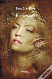 Ecchymose