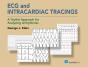 Ecg And Intracardiac Tracings - Preview