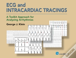 Capa do artigo Ecg And Intracardiac Tracings