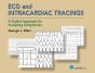 Ecg And Intracardiac Tracings - Preview