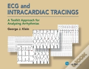 Capa do artigo Ecg And Intracardiac Tracings