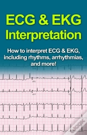 Capa do artigo Ecg & Ekg Interpretation