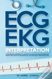 Ecg / Ekg Interpretation