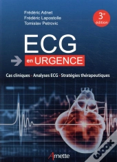Ecg En Urgence