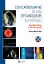 Echocardiographie De Suivi Des Marqueurs Acoustiques - Preview