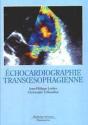 Echocardiographie Transoesophagienne - Preview
