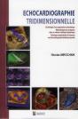Échocardiographie Tridimensionnelle - Preview