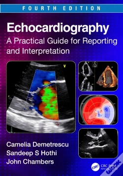 Capa do artigo Echocardiography