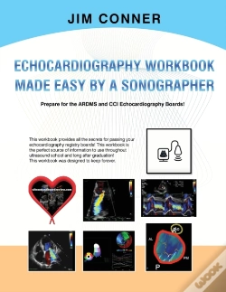 Capa do artigo Echocardiography Workbook
