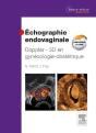 Echographie Endovaginale Doppler - 3d  6e - Preview