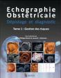 Echographie Obstetricale. Depistage Et Diagnostic Tom 1 Gestion Des Risques - Preview