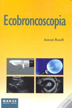Capa do artigo Ecobroncoscopia