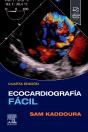 Ecocardiografia Facil +Student Consult - Preview