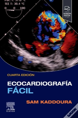 Capa do artigo Ecocardiografia Facil +Student Consult