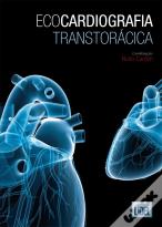 Ecocardiografia Transtorácica