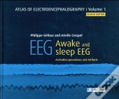 Eeg - Awake And Sleep Eeg