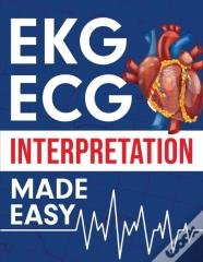 Ekg | Ecg Interpretation Made Easy