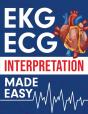 Ekg | Ecg Interpretation Made Easy - Preview