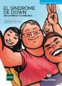 El Síndrome De Down - Preview