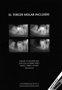 Capa do artigo El Tercer Molar Incluido
