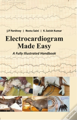 Capa do artigo Electrocardiogram Made Easy