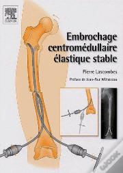 Embrochage Centromédullaire Élastique Stable