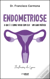 Capa do artigo Endometriose