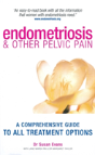 Endometriosis And Other Pelvic Pain - Preview