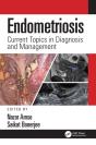 Endometriosis - Preview