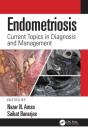 Endometriosis - Preview