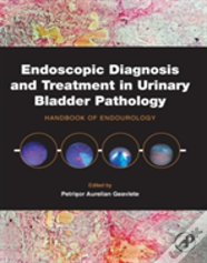Endoscopic Diagnosis And Treatment In Urinary Bladder Pathology