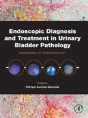 Endoscopic Diagnosis And Treatment In Urinary Bladder Pathology - Preview