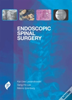 Capa do artigo Endoscopic Spinal Surgery