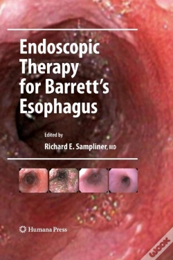 Capa do artigo Endoscopic Therapy For Barrett'S Esophagus