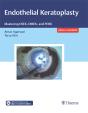 Endothelial Keratoplasty - Preview