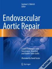 Endovascular Aortic Repair