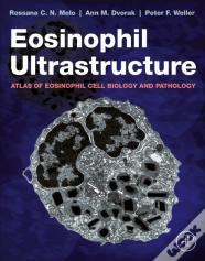 Eosinophil Ultrastructure