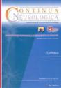 Epilepsia - Preview