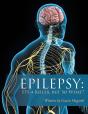 Epilepsy - Preview