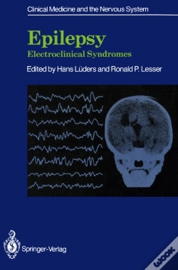 Capa do artigo Epilepsy
