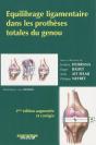 Équilibrage Ligamentaire De La Prothèse Du Genou (2e Édition) - Preview