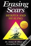 Erasing Scars