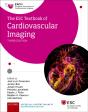 Esc Textbook Of Cardiovascular Imaging - Preview
