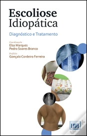 Capa do artigo Escoliose Idiopática