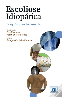Capa do artigo Escoliose Idiopática