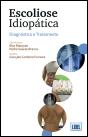 Escoliose Idiopática - Preview