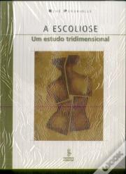 Escoliose
