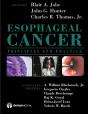Esophageal Cancer - Preview