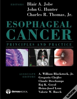 Capa do artigo Esophageal Cancer