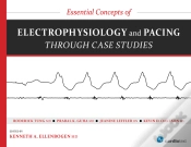 Capa do artigo Essential Concepts Of Electrophysiology And Pacing Through Case Studies